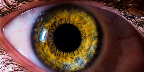 Dilatación pupila (midriasis) y Contracción pupila (miosis)